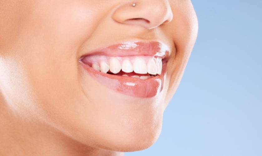 Best teeth whitening options